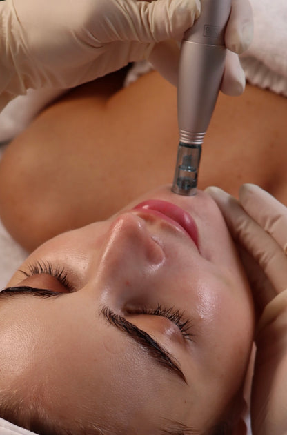 Microneedling Microbiome+Gold