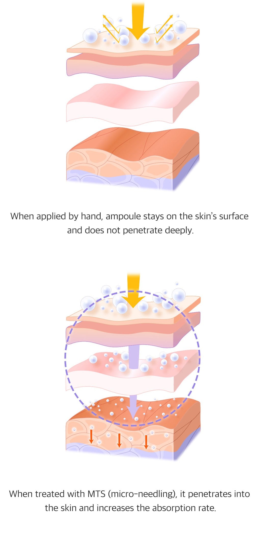 Microneedling Hautelastizität mit  Idebenone- Früchte extrakt