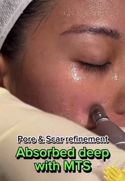 Microneedling Gold + Collagen
